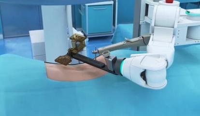 手术机器人正在打开医疗市场